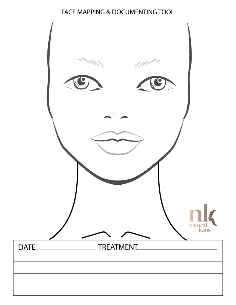 Printable Botox Face Map Printable Botox Face Map