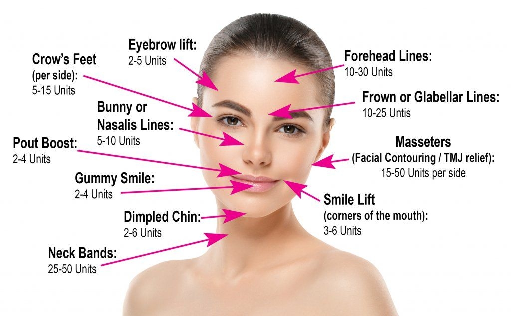Printable Botox Injection Face Map